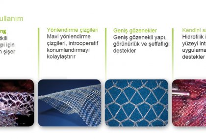 TiO2Mesh&trade; &ndash; Yenilik&ccedil;i hernia tamiridir.